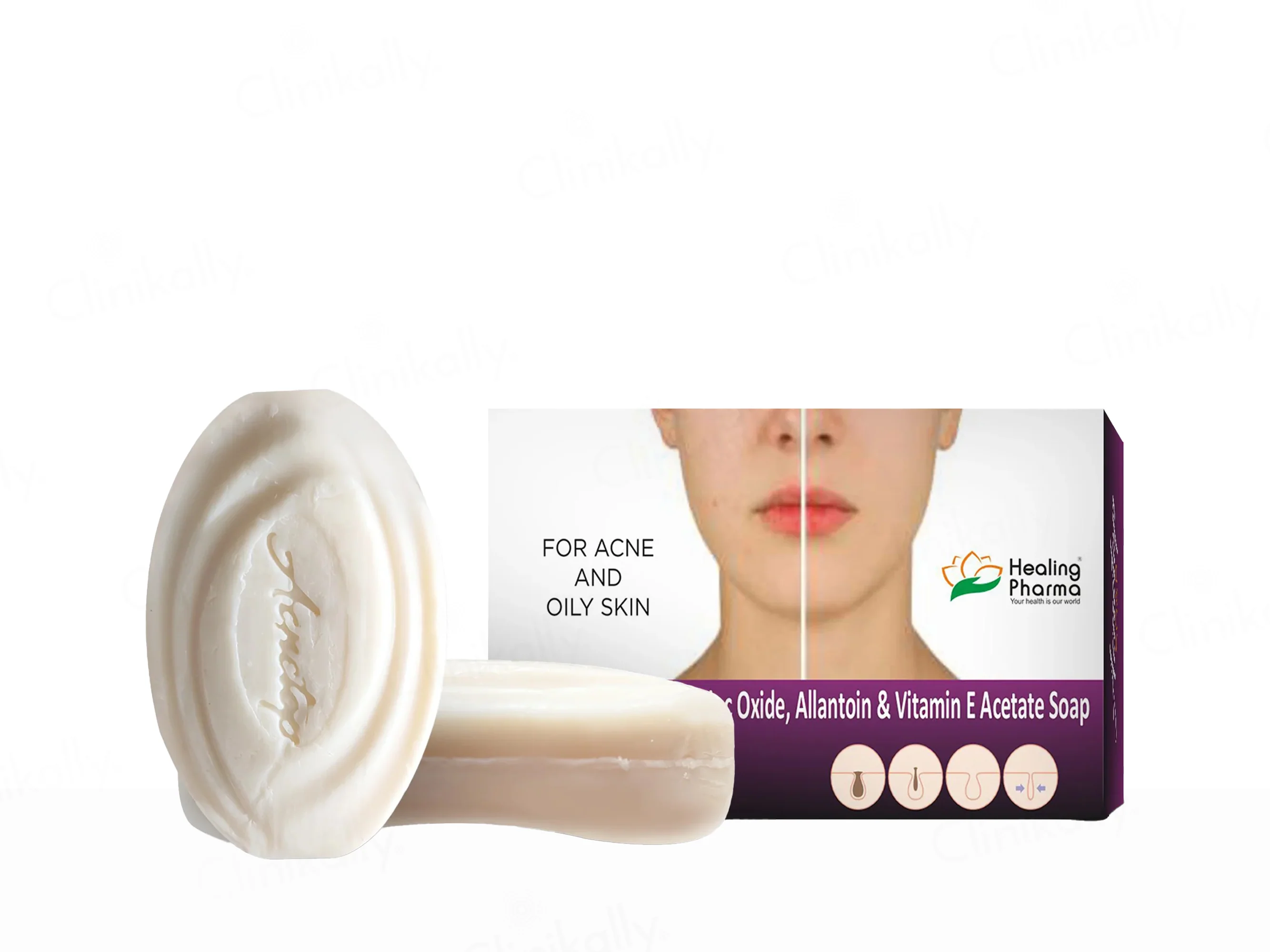 Acnetop Soap - Image 2