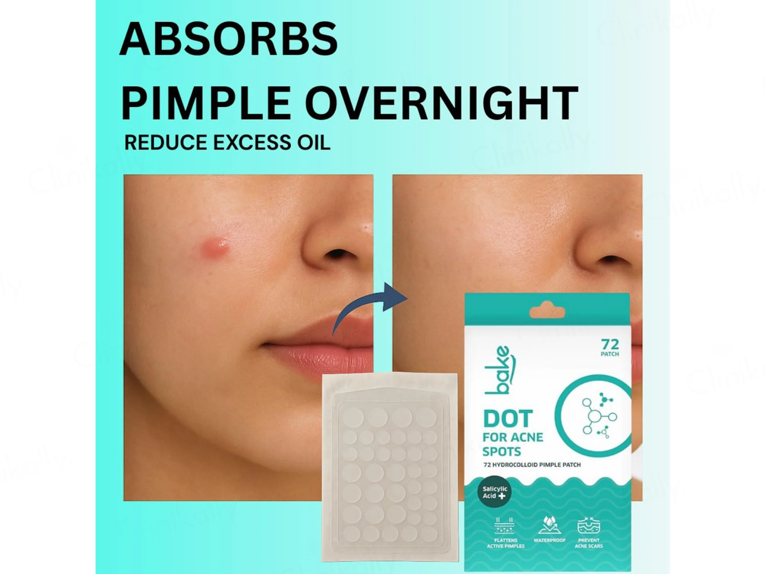 Bake Salicylic Acid Dot Acne Patch - Image 5