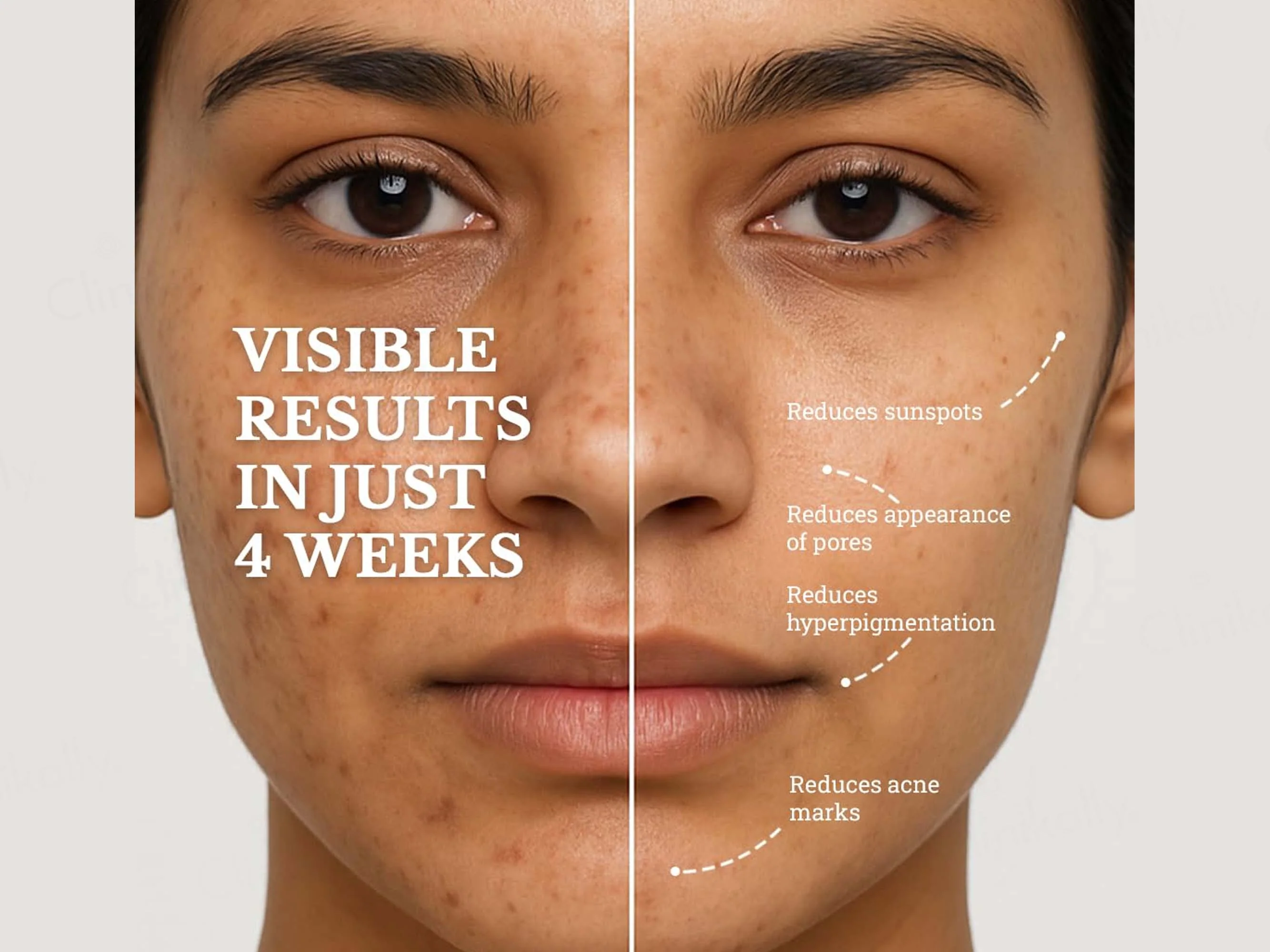 Be Clinical Blemish Balance Serum - Image 4
