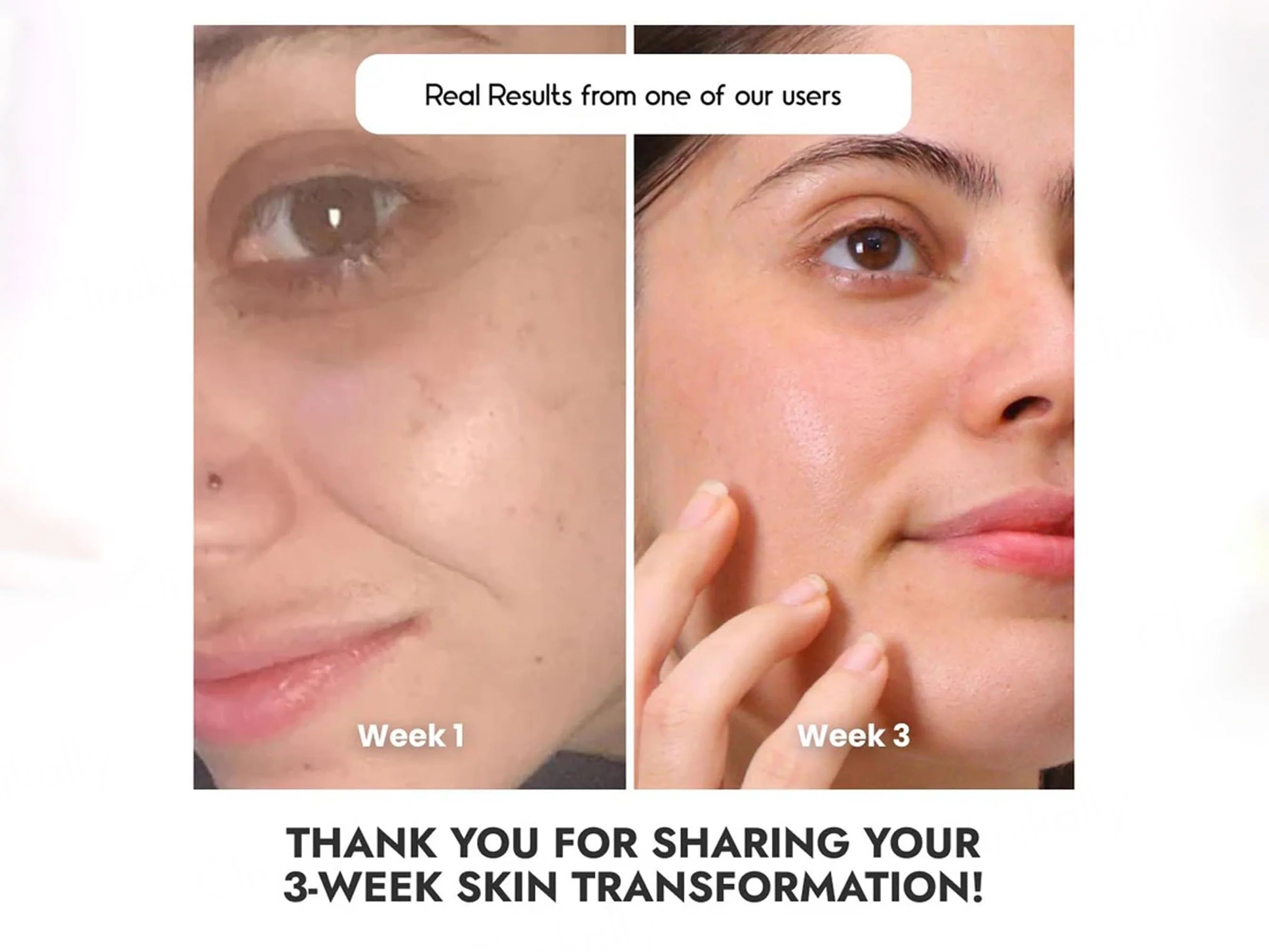 CosiQ Vitamin C-8% Ethylated Ascorbic Acid Face Serum - Image 9