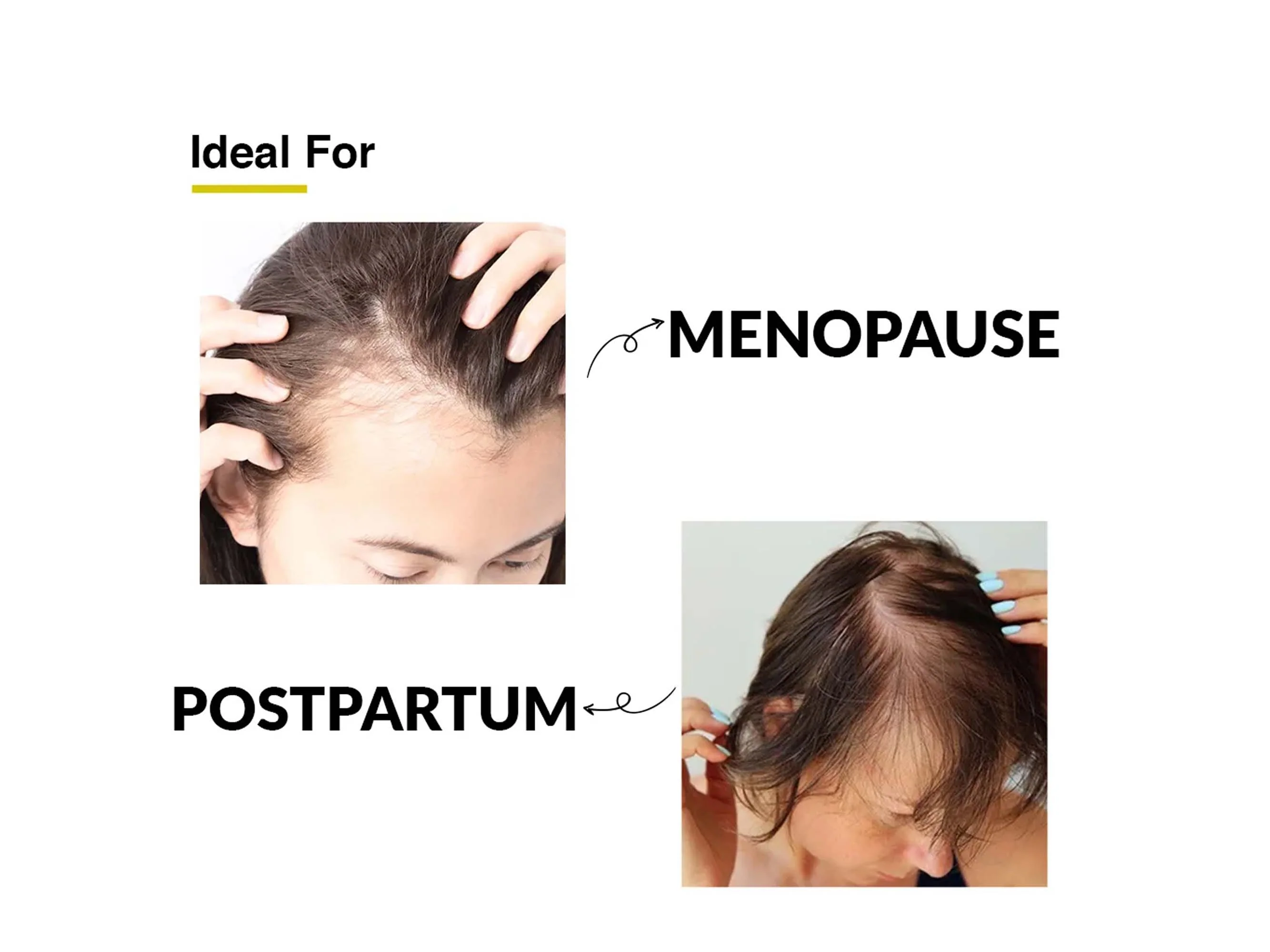Fixderma Kairfoll Femme Specifique Shampoo - Image 6
