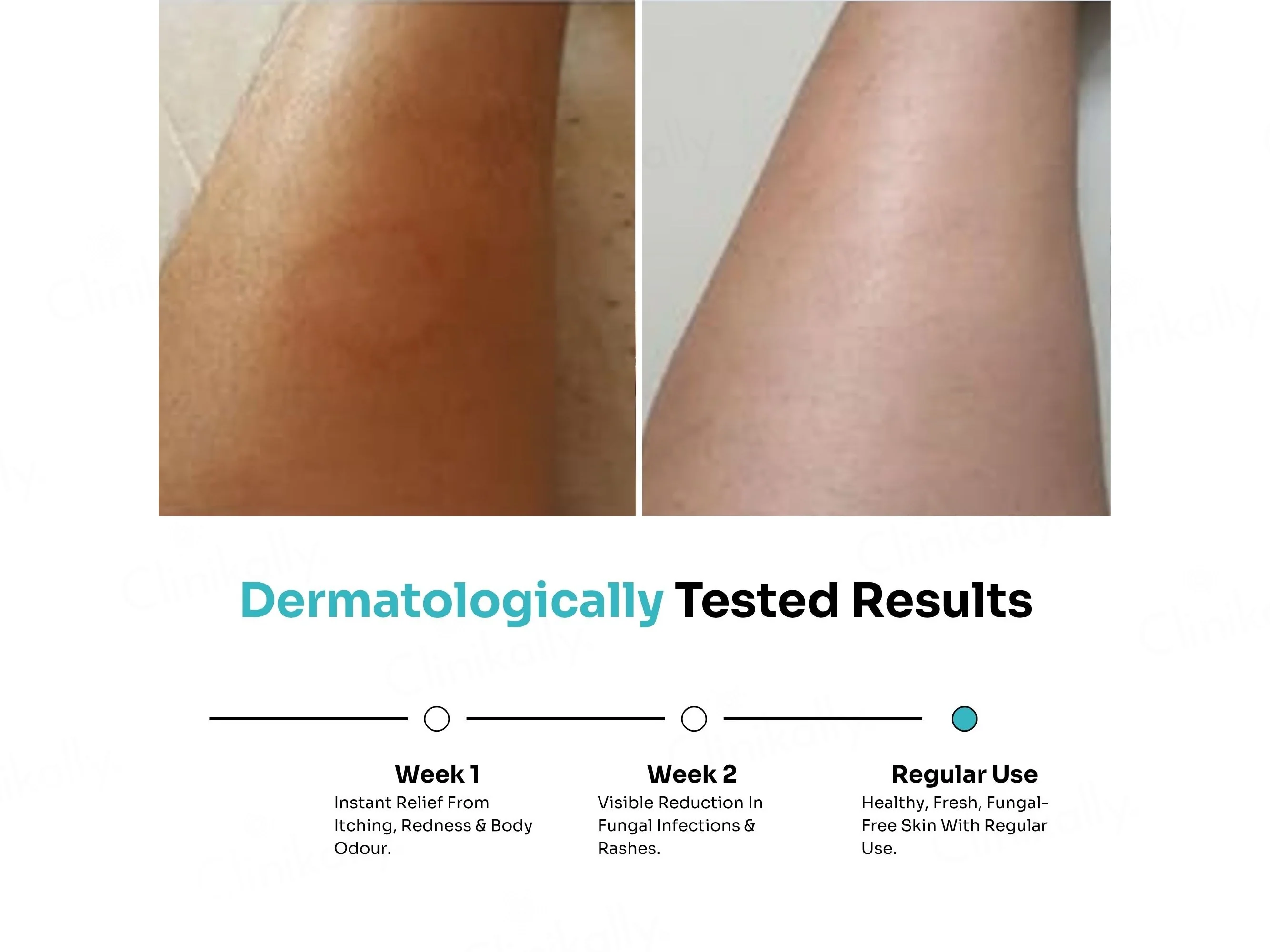 Kitcoz Anti Fungal Body Wash For Men & Women - Image 3