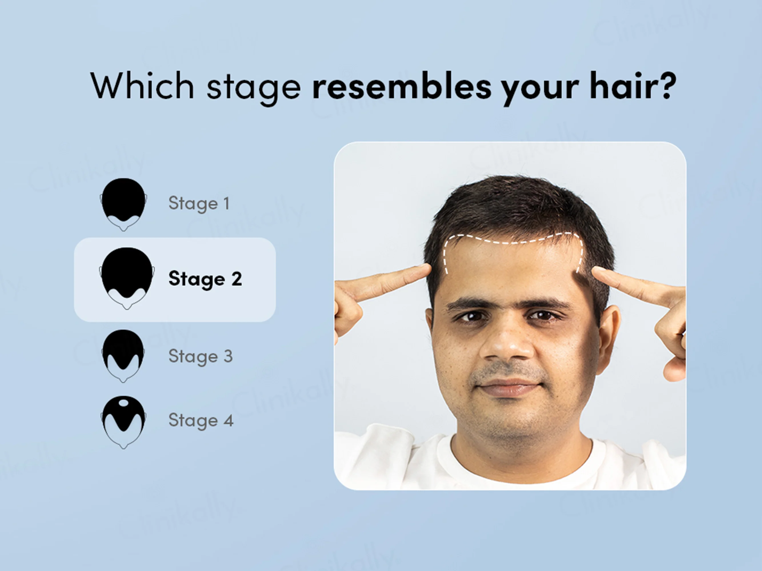 Man Matters Growmax 5% Hair Topical Solution - Image 3