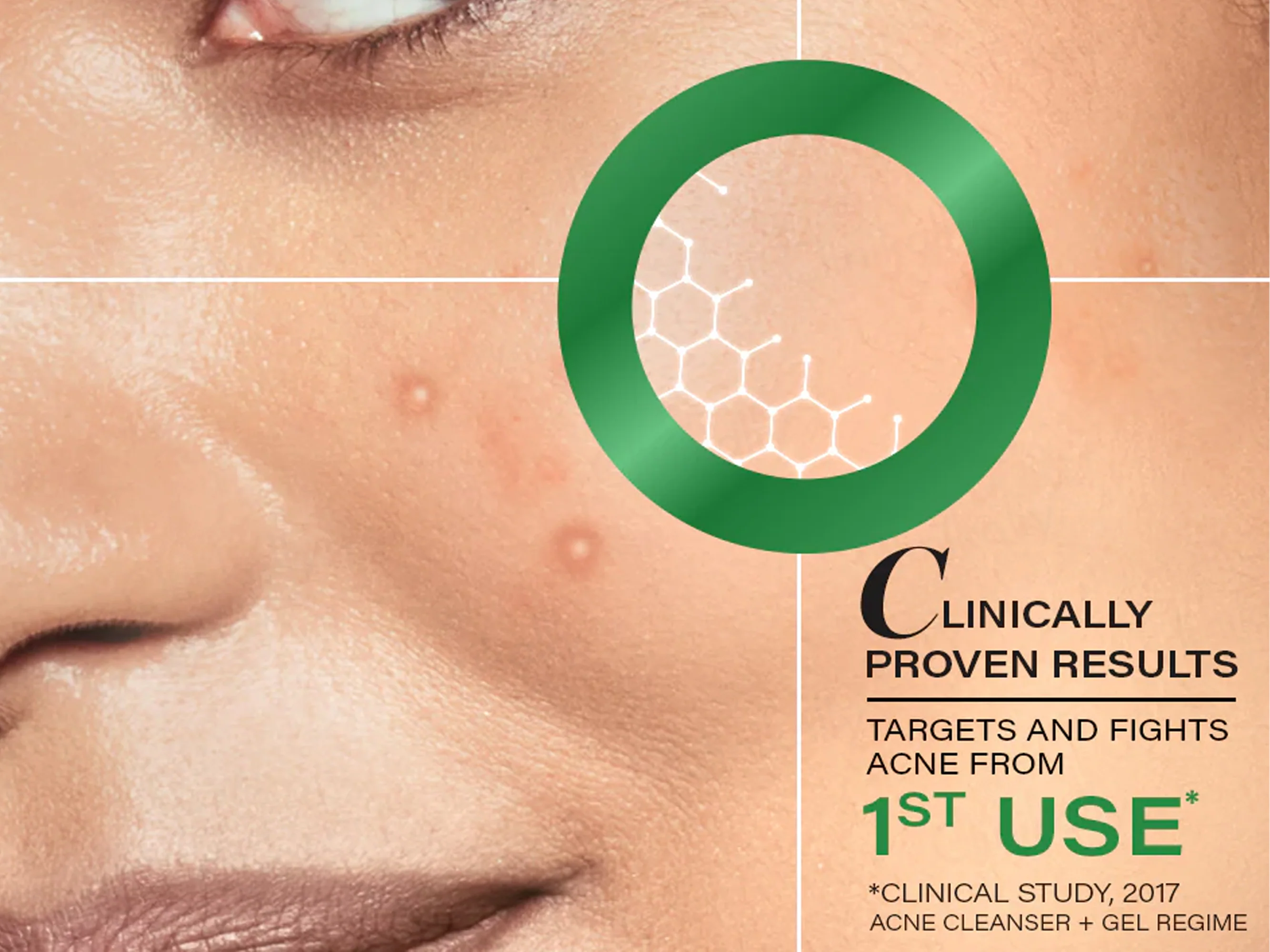 Novology Acne Rescue Spot Corrector Gel - Image 4