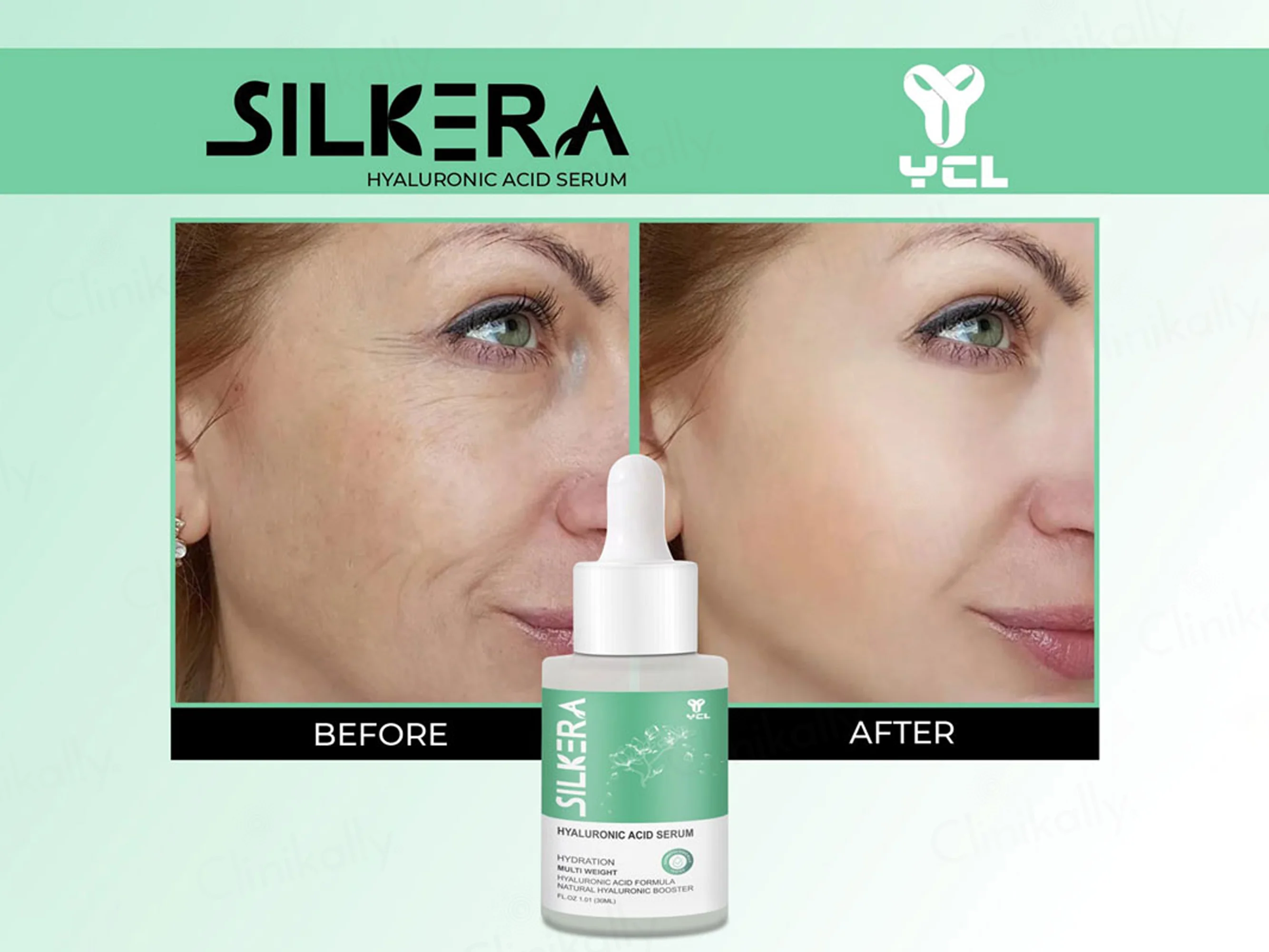 Silkera Hyaluronic Acid Serum - Image 7