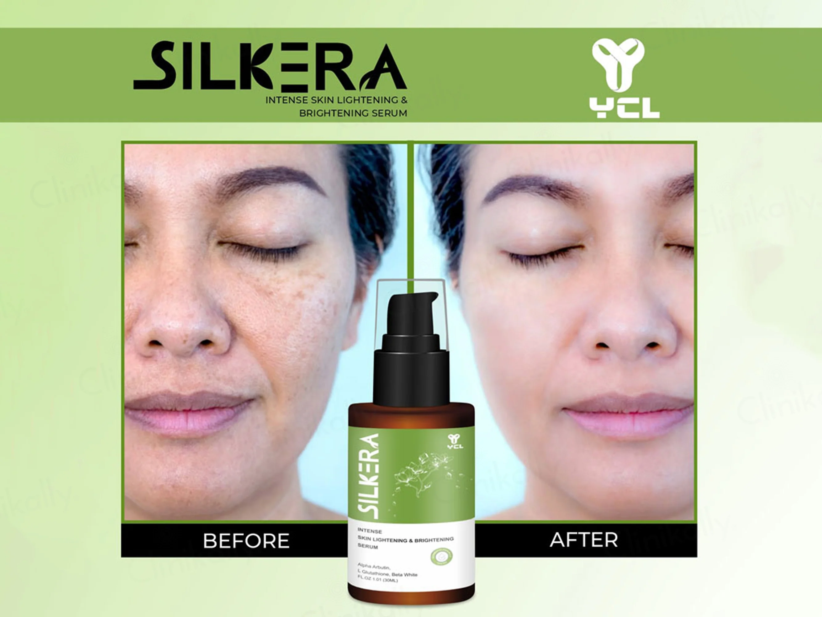Silkera Skin Lightening & Brightening Serum - Image 6