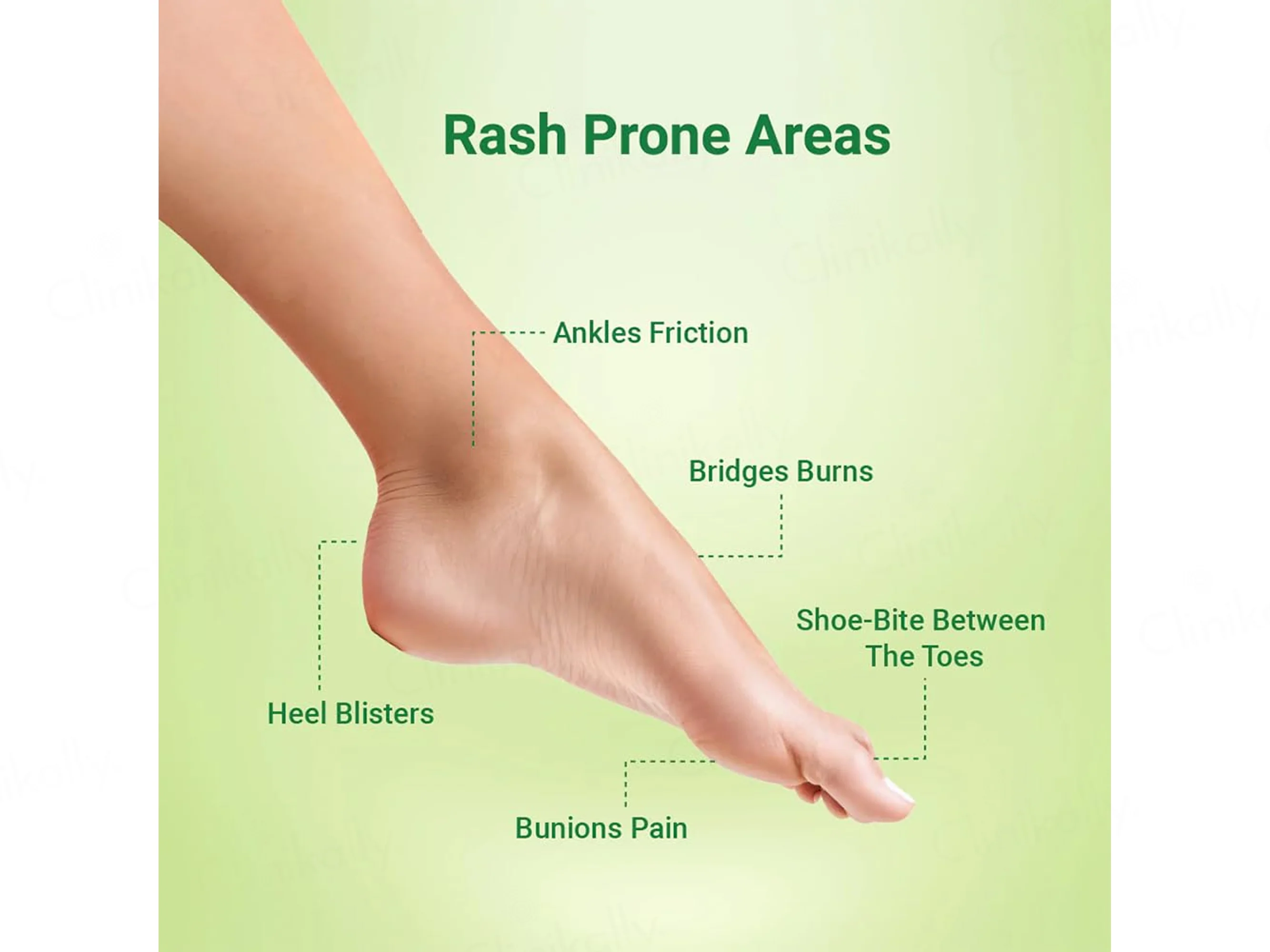 Skin Easi Comfoot Anti Shoe-Bite Gel - Image 3