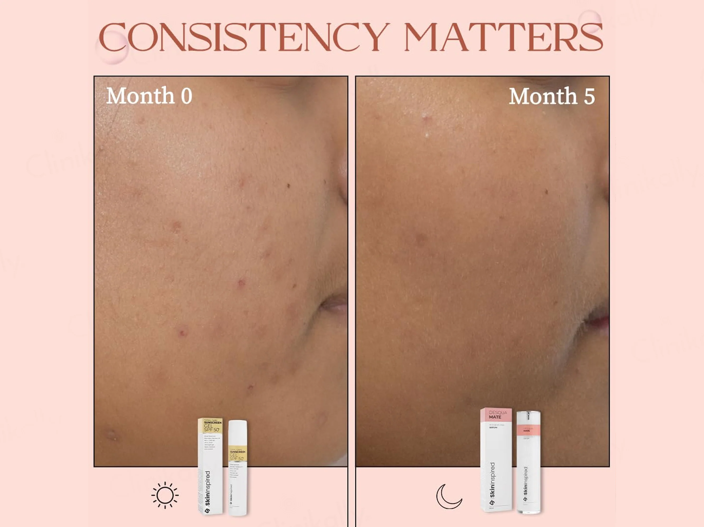 SkinInspired Desqua Mate AHA BHA PHA Face Serum - Image 10