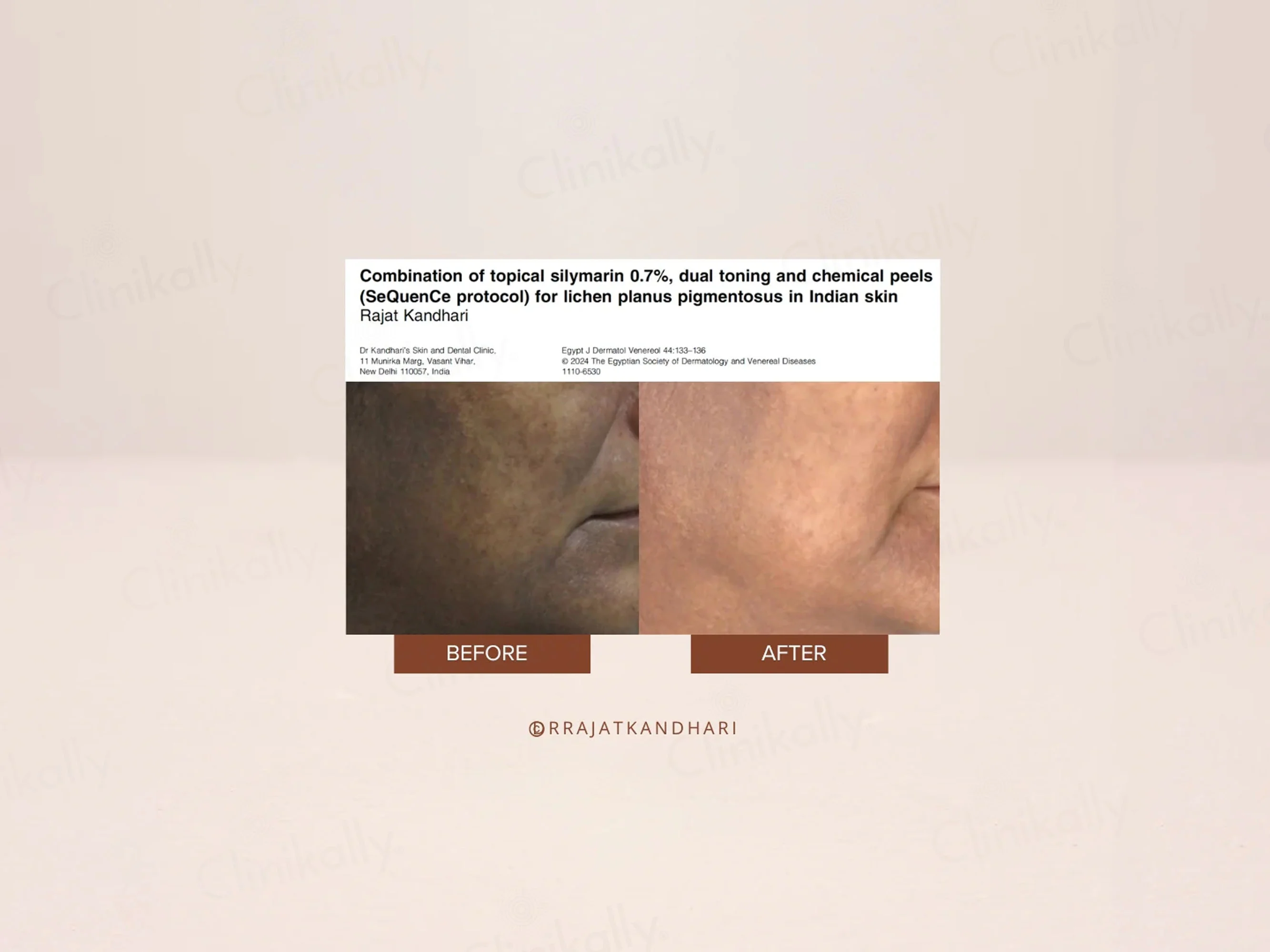 The Facecraft Project Restore Retinol Skin Brightening Cream - Image 6