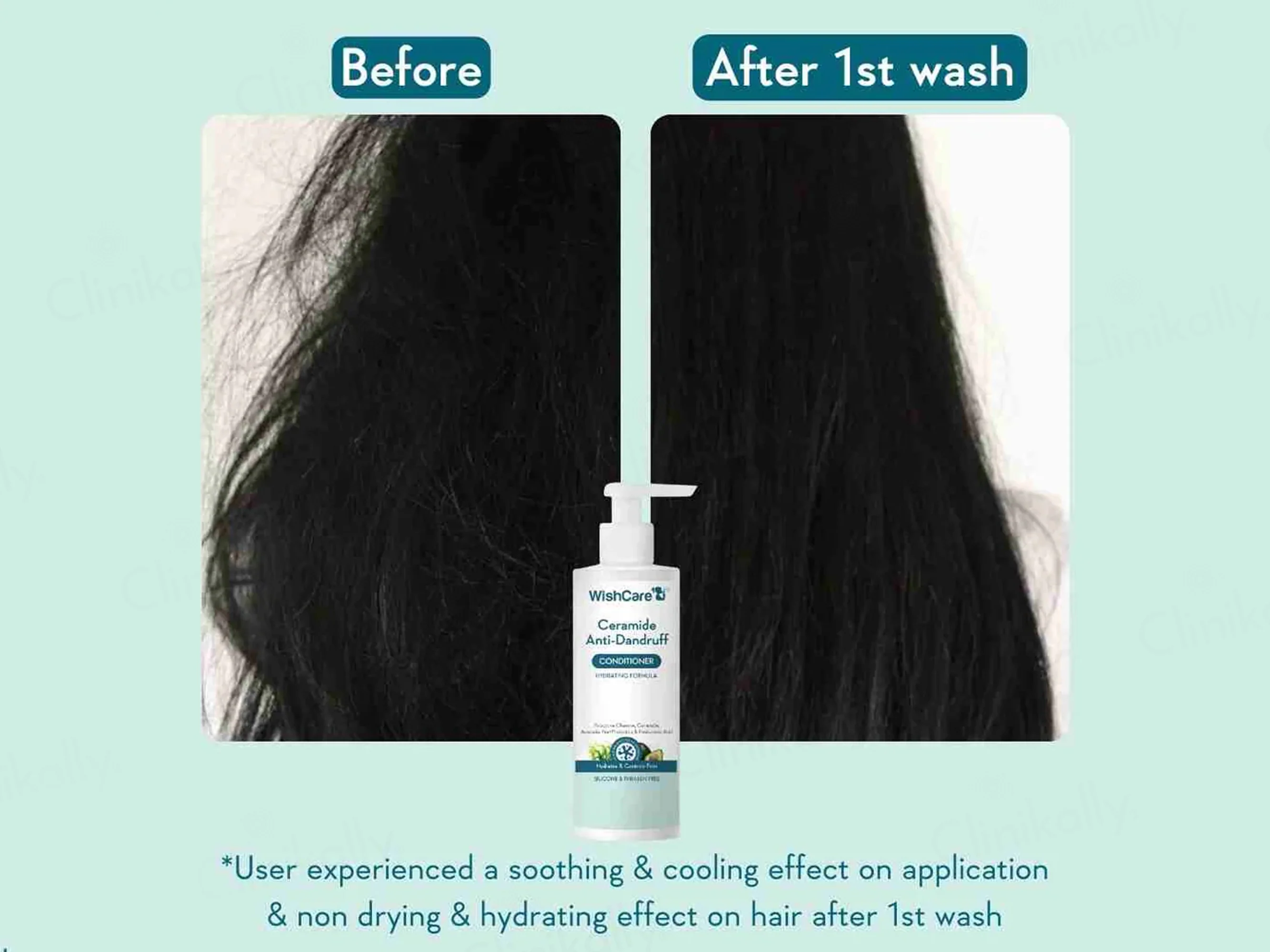 WishCare Ceramide Anti-Dandruff Conditioner - Image 3