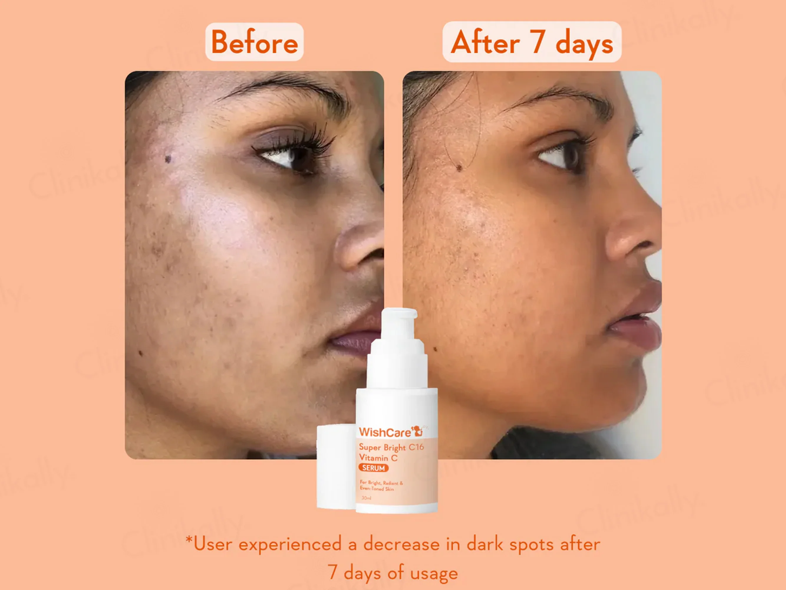 WishCare Super Bright C16 Vitamin C Serum - Image 5