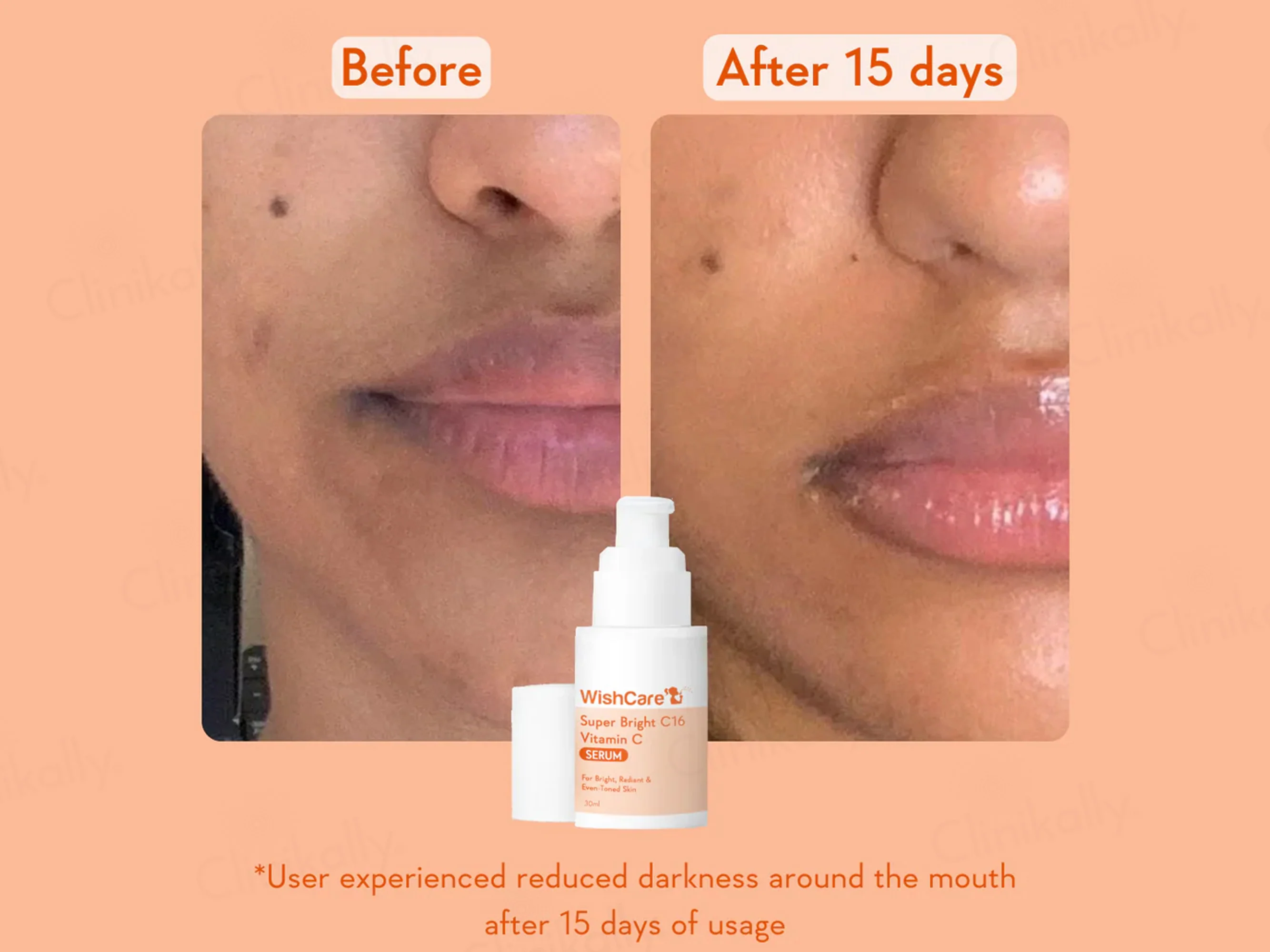 WishCare Super Bright C16 Vitamin C Serum - Image 6