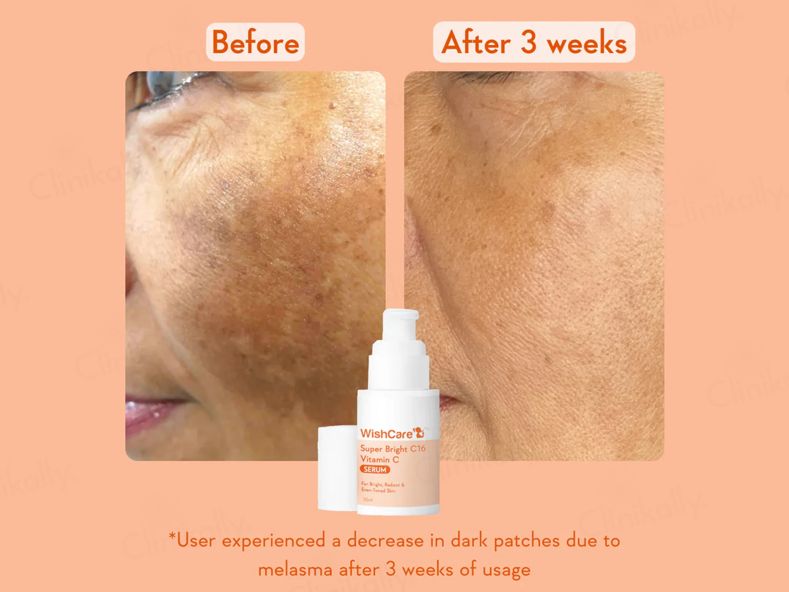 WishCare Super Bright C16 Vitamin C Serum - Image 7